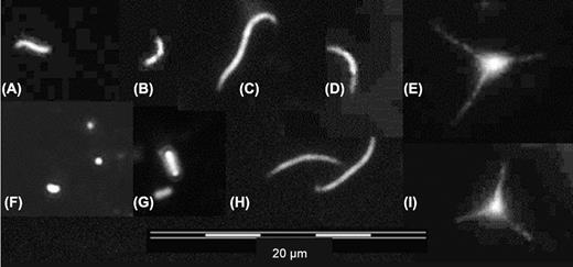 (A)-(I) Major aerobic anoxygenic phototroph (AAP) morphotypes in the studied shallow lakes.