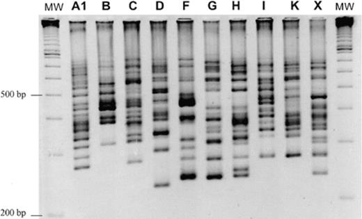 New PCR-ribotyping fingerprints of 10 C. difficile serogroups. MW: 100-bp molecular mass marker (Pharmacia).