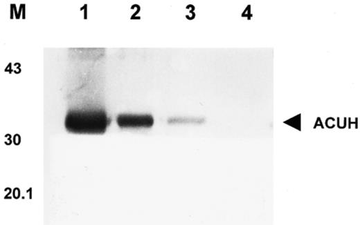 Detection of ACUH by Western blotting. Lane 1, total protein (10 μg) from E. coli over-expressing cells. Lanes 2 and 3, mitochondrial and peroxisomal (17 000×g) enriched fraction (250 μg) from A. nidulans R21 (wild-type) (lane 3) and T1 over-expressing strain (lane 2) grown under inducing conditions. Lane 4, mitochondrial and peroxisomal enriched fraction (250 μg) of T1 over-expressing strain grown on glucose minimal medium. M, position of the molecular mass markers in kDa.