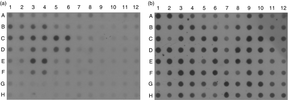Macro-array dot-blot. Membranes blotted with amplified cDNA sequences from subtracted library, probed with total cDNA population from Trichophyton rubrum cultured into drug-free medium (a) and reprobed with total cDNA population from T. rubrum exposed to fluconazole (b). Differentially expressed transcripts obtained from T. rubrum challenged with cytotoxic drugs represent the clones with stronger signals (b) compared to control (a).