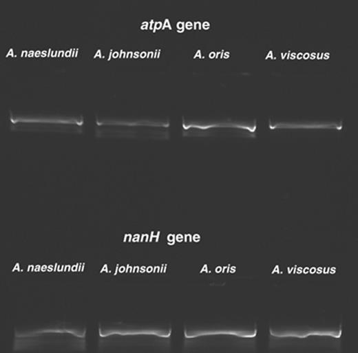 Reverse transcriptase (RT)-PCR assays showing expression of nanH and the housekeeping gene atpA in the type strains of Actinomyces oris (CCUG 34288; EU805602), and Actinomyces johnsonii (CCUG 34287; EU805600), Actinomyces naeslundii (CCUG 2238; EU805601) and Actinomyces viscosus (NCTC 10951; EU805603). Negative controls, omitting the RT in the reaction mix, yielded no amplicons from any strain.