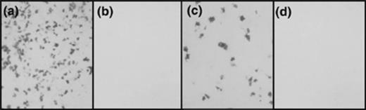 Staining of COS7 cells for functional expression of placental alkaline phosphatase following transfection with various control signal sequence/AP-PST vector constructs. (a) PLAP containing its endogenous signal sequence. (b) Signalless PLAP. (c) S. mansoni Ca2+ transport ATPase signal sequence. (d) S. mansoni elastase signal sequence.