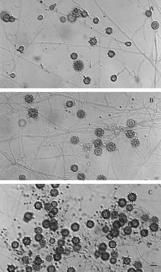 Microscopic morphology of H. capsulatum isolated from a BALB/c mouse inoculated with a sample from a planter (S-162) of restaurant A. (A) EH-554P from lung; (B) EH-554H from liver; (C) EH-554B from spleen. Bar = 10 µm.