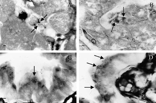 Histopathological findings of mice inoculated with the S-160 sample. (A, B) Yeast-cells within Kupffer's cells; (C, D) Yeast-cells within epithelial cells from the bronchiole. Arrows indicate intracellular yeasts stained using the Grocott method. Bar = 10 µm.