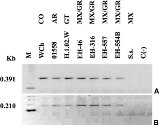 Identification of H. capsulatum by nested-PCR of fungal DNA samples. The assay was performed with two sets of fungal-specific primers of the 100-kDa protein gene of H. capsulatum (see details under Section 2). PCR products were analyzed by electrophoresis through 1.5% agarose gels containing ethidium bromide. First (A) and nested (B) PCR reactions. M — molecular weight marker was estimated from 123 bp DNA Ladder; WCh, 01558, H.1.02.W, EH-46, EH-316, and EH-557 –H. capsulatum clinical isolates from different geographic origins of the American Continent; EH-554B –H. capsulatum isolate from the X hotel; Ss –S. schenckii (DNA negative control); C (−) Negative control of the system. Abbreviations: CO — Colombia; AR — Argentina; GT; Guatemala; MX/GR — Mexico/Guerrero.