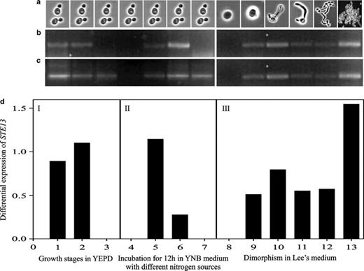 Differential expression of STE13ca gene in C. albicans ATCC 10231 during different growth phases, nitrogen sources and during dimorphism using RT-PCR. (a) Digital imagery of cellular morphology, (b) cDNA STE13ca gene, (c) 18S rDNA cDNA, and (d) STE13ca gene expression. (d)-I Growth phases in YEPD: (1) logarithmic, 6 h; (2) early stationary, 12 h; (3) late stationary, 24 h. (d)-II Incubation for 12 h in YNB medium with different nitrogen sources: (4) YNB, (5) YNB–proline, (6) YNB–NH2, (7) YNB–peptone. (d)-III Dimorphism in Lee's medium: (8) phase G1, (9–10) germinal tube formation, (11–12) pseudomycelium formation, (13) mycelium formation. The intensity of bands STE13ca cDNA was normalized to the intensity of 18S rDNA cDNA.
