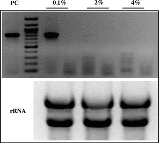 Transcription of CaGS gene in response to different glucose concentration in the growth medium. RT-PCR of total RNA extract from yeast grown in the YNB with different glucose concentration. Lanes: (0.1%), RT-PCR at 0.1% glucose concentration and non-RT-PCR as a negative control; (2%), RT-PCR at 2% glucose concentration and non-RT-PCR as a negative control; (4%), RT-PCR at 4% glucose concentration and non-RT-PCR as a negative control; (PC), PCR using genomic DNA template as a positive control; (rRNA), control of RNA using for RT-PCR. 80 × 70 mm (300 × 300 DPI).