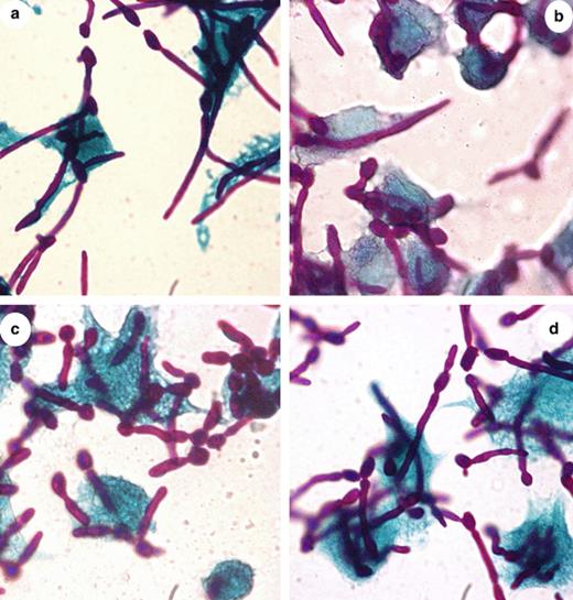 Macrophage infected with CAI12 and CaGS mutants. Yeast cells were resuspended in DMEM and added to the monolayer of macrophages in approximate moi 5/1. After incubation at 37 °C for 1 h, cells were fixed and stained with the Hochtkiss–MacManus coloration. Magnification 100×. Photos a, b, c and d correspond, respectively, to the CAI12, CAL1, CAL3 and CALRE. 123 × 129 mm (300 × 300 DPI).
