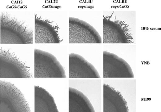 Effect of CaGS disruption on filamentation. Control strain (CAI12), heterozygous mutant (CAL2U), homozygous mutant (CAL4U), and heterozygous revertant (CALRE) strains were spotted on agar plates made with 10% serum, YNB (containing 0.1% glucose and 10% serum) and M199 (pH 7.0) and incubated at 37 °C for 5–6 days. 159 × 107 mm (300 × 300 DPI).