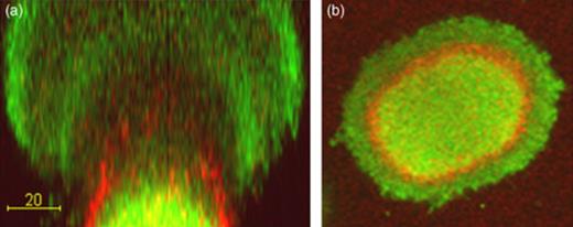 Confocal scanning laser microscopy micrographs acquired in a propidium iodide-stained biofilm formed by Gfp-tagged Pseudomonas aeruginosa PAO1. (a) Vertical section through a mushroom-shaped multicellular structure; (b) horizontal section through a mushroom-shaped multicellular structure. The bacteria appear green fluorescent and the eDNA appears red fluorescent. Size bar=20 µm. Reproduced from Allesen-Holm (2006).