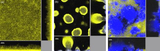 Confocal scanning laser microscopy (CSLM) micrographs acquired in biofilms formed by Pseudomonas aeruginosa pvdA (a), a pilA/pvdA mixture (b), and a pilApvdA/wild-type mixture (c). The wild type and pvdA mutant were tagged with Yfp (yellow), whereas the pilA mutant and the pilApvdA mutant were tagged with Cfp (blue). The central pictures show horizontal CLSM optical sections, and the flanking pictures show vertical CLSM optical sections. Size bars=20 µm. Reproduced from Yang (2009).