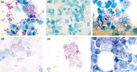Photomicrographs illustrating the effect of antibiotic treatment on Diplorickettsia massiliensis-infected XTC cells by Gimenez staining (100× magnification). Control, 15 days postinfection (a); negative control (b); rifampin (0.25 µg mL−1) (c); rifampin (0.5 µg mL−1) (d); rifampin (1 µg mL−1) showed little infection compare with control (e); rifampin (2 µg mL−1) showed no sign of infection after 15 days of treatment (f).