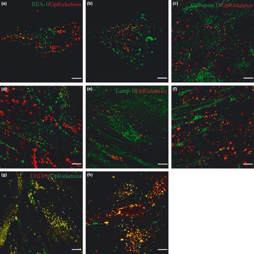 Intracellular localization of Diplorickettsia massiliensis with HEL and MRC-5 cells. Intracellular localization D. massiliensis was studies in HEL cells (a, c, e, g) and in MRC-5 cells (b, c, f, h) by immunofluorescence and confocal microscopy. (a, b) Colocalization of D. massiliensis (red) with EEA-1 (green). (c, d) Colocalization of D. massiliensis with Cathepsin D (green). (e, f) colocalization of D. massiliensis (red) with Lamp-1 (green). (g, f) colocalization of D. massiliensis (green) with Lysotracker DND99 (red).