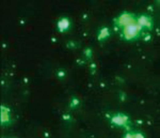 Bartonella elizabethae visualized in IFA assay. Magnification ×100.