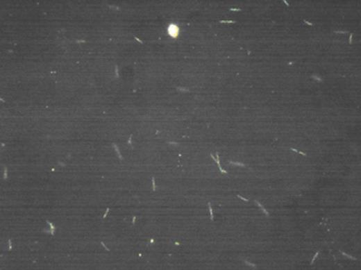 Borrelia visualized in dark microscopy. Magnification ×40.