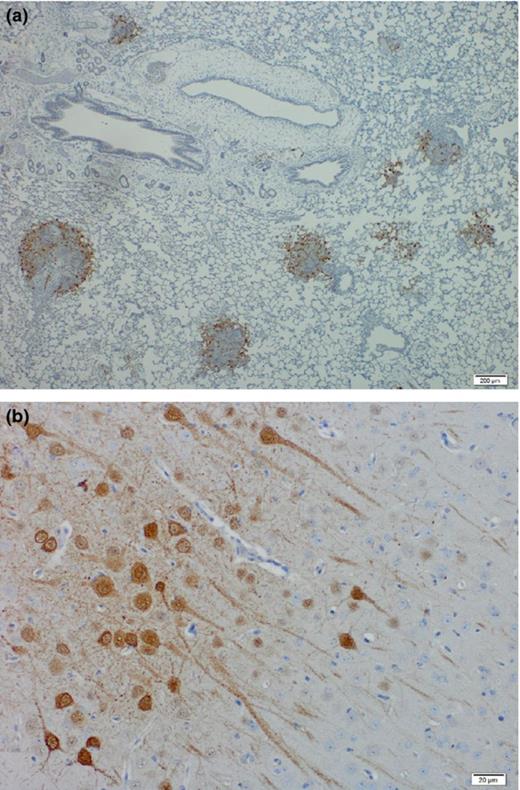 Tropism of lethal Henipavirus infection in ferrets. Hendra virus antigen is present in (a) focal areas of necrotizing alveolitis and (b) neurons in the brain. Sections were stained for HNV nucleoprotein (brown).