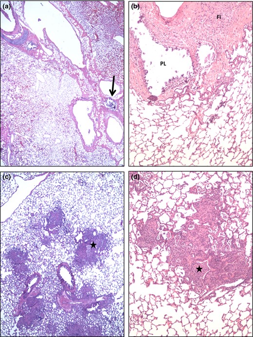 Lung micrographs from ΔHspX (X4 19) infected guinea pigs. (a and b) Occasional remnants of primary lesions (PL, arrow) are apparent in the interstitium supporting bronchioles and larger pulmonary vessels. In b the mineralized material, characteristic of late stage primary lesions, have fallen out during tissue processing. Such lesions are often accompanied by marked fibrosis (Fi). (c and d) Small/restricted areas of secondary lesions are seen in some lungs of this group and characterized by a mild to moderate, mostly compact lympho histiocytic infiltrate in the alveoli and bronchiolitis (stars) also involving hetrophil infiltration.