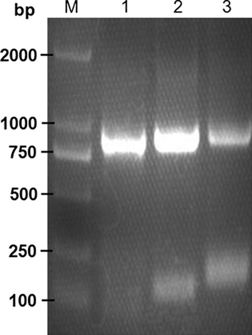 Identification of three sequential PCR products of SCE gene by 2.0% agarose gel electrophoresis. M: DNA marker DL2000; 1–3, three PCR products of SCE gene (868, 900, and 930 bp).