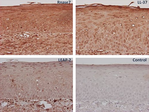 Immunohistochemical staining of the tonsils. Tonsillar tissue slides obtained from non allergic individuals and patients with allergic rhinitis were incubated with antibodies against RNase7, LL 37, and LEAP 2 and visualized by 3,3 diaminobenzidine (brown). All slides were counterstained with hematoxylin (blue). In control slides, N series universal negative control reagent was used. Magnification 40–100×.