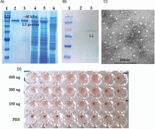 Analysis of the purified VLPs. HPV-16 L1 VLPs were expressed in and purified from recombinant baculovirus-infected Sf9 cells. (A) Samples were separated on 12% SDS-PAGE: 1, molecular size markers; 2 and 3, purified L1 VLP protein; 4 and 5, unpurified L1 VLP protein (Sf9 cells infected with HPV-16 L1 recombinant baculovirus) and 6, uninfected Sf9 cells. (B) Western blot: proteins on SDS-PAGE gel were transferred onto nitrocellulose membrane and L1 proteins were detected using the anti-HPV-16 L1 monoclonal antibody: 1, molecular size markers; 2, uninfected Sf9 cells; 3, Sf9 cells infected with HPV-16 L1 recombinant baculovirus. (C) Electron micrographs of negatively stained VLPs under TEM. Purified VLPs were negatively stained with 1% uranyl acetate and observed under TEM (Hitachi TEM, model HU 12-A) at 90 000 × magnifications. VLPs were approximately 55 nm in diameter. (D) HA: purified VLPs agglutinate mouse erythrocytes. Different amounts of purified VLPs were serially diluted two-fold in 50 μl PBS and mixed with an equal volume of the 1% mouse RBC suspension in PBS per well of a 96-well plate. The samples were incubated for 3 h at 4°C and photographed.