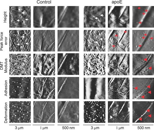 AFM imaging of Legionella pneumophila cells treated with human apoE. The bacteria were incubated without (control) or in the presence of apoE (0.4 mg mL−1) and imaged by AFM. The height, peak force error, adhesion, elasticity (DMT modulus) and deformation images are presented. The brighter and darker areas of the images correspond to the higher and lower values of the parameters, respectively. The round structures reflecting the vacuoles and granule-like protuberances are marked by white and red arrows, respectively. In the DMT modulus, adhesion and deformation maps of the apoE-treated bacteria the red arrowheads indicate separate areas of distinct properties in comparison with the rest of the surface.