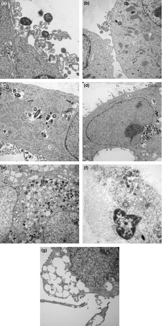 Cytopathic changes induced in A549 cells during interaction with NTHi strain. A549 cells were infected with NTHi strain at MOI of 1 : 10, fixed at various time points after infection and examined by transmission electron microscopy (a) 15 min (×6450), (b) 45 min (×3000), (c) 2 h (×3900), (d) 4 h (×3000), (e) 8 h (×1800), (f) 12 h (×2325), and (g) 24 h (×3900). Images shown are representative of two independent experiments.
