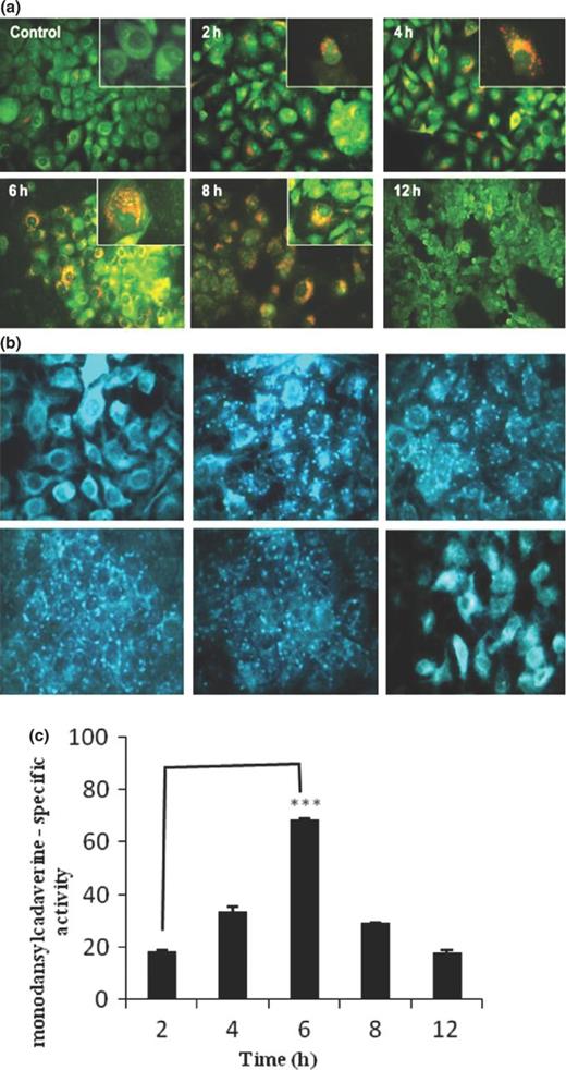 Evaluation of autophagic vacuole formation in A549 cells infected with NTHi strain. After infection for indicated times (2, 4, 6, 8, and 12 h), A549 cells were washed with PBS and incubated with fresh medium containing (a) AO (1 mg mL−1) for 15 min and (b) 0.05 mM monodansylcadaverine in PBS for 10 min, washed with cold PBS and immediately examined by fluorescence microscopy. Uninfected cells were taken as control. Representative images were obtained from two independent experiments. (Inset: Enlarged microscopic view, 100×). (c) After incubation with 0.05 mM monodansylcadaverine at 37°C for 10 min, cells were washed with PBS and collected in 10 mM Tris-HCl, containing 0.1% Triton X-100. The amount of incorporated monodansylcadaverine was quantitated using Cary Eclipse fluorometer. The data represent the mean ± SEM of three independent experiments. ***P ≤ 0.001 indicates statistically significant difference between time points of infection.