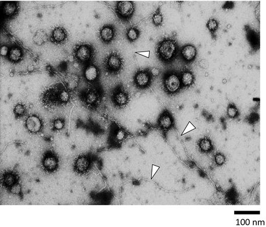 Shown is a representative electron micrograph of a strain ATCC 33277 OMV preparation. Samples were negatively stained with uranyl acetate and visualized at x 50 000. Many OMVs were clearly visible as spherical structures with different sizes ranging from 50 to 150 nm in diameter. Fimbrial structures were also found as long and fine structures approximately 5 nm in thickness (arrowheads). Bar: 100 nm.