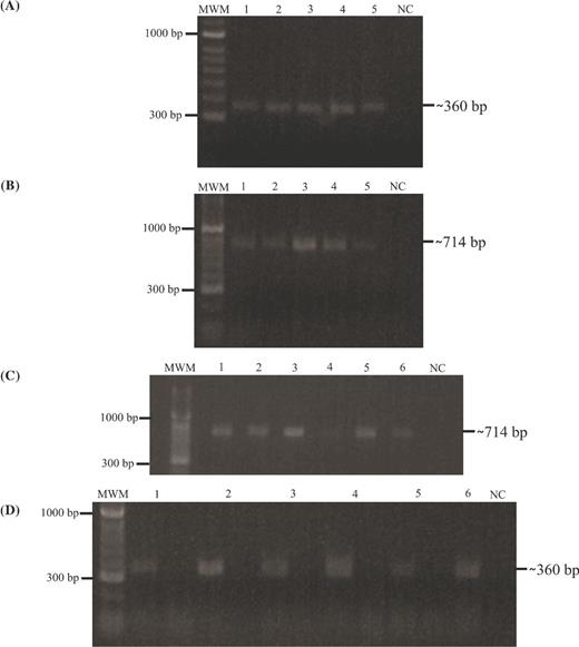 rv3494c gene presence and transcription. MWM: 100-bp molecular weight marker; 1. M. tuberculosis H37Rv; 2. M. tuberculosis H37Ra; 3. M. bovis; 4. M. bovis BCG; 5. M. africanum; 6. Positive PCR control (M. tuberculosis H37Rv gDNA). NC: negative PCR control. (A)rpoB gene amplification from gDNA; (B)rv3494 PCR product amplified from genomic DNA isolated from different mycobacterial species and strain; (C)rpoB gene amplification from cDNA. Left line: plus synthesis and right line: minus synthesis; NC: negative PCR control. (D)rv3494 gene amplification from cDNA of the samples included in this study.