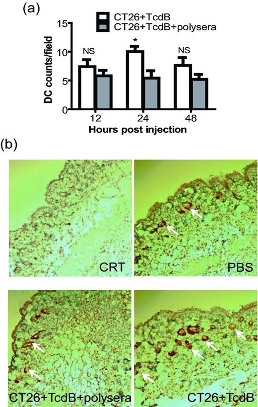 DC immigration induced by TcdB-exposed CT26 cells in vivo. Mouse tissues were collected 12, 24 or 48 h after injection of TcdB-treated CT26 cells. Tissue DCs were detected by immunohistochemistry performed on sections from paraffin-embedded tissue blocks using CD11c antibodies and DAB visualization; the nuclei were stained with hematoxylin. (a) Quantitative analysis of the number of DCs from five equivalent fields in each tissue section. These data represent the mean of five-field determinations ± SEM and were analyzed by unpaired two-tailed t-test. * represents P < 0.05 for TcdB group (CT26 + TcdB) vs antitoxin pretreatment group (CT26 + TcdB + polysera). (b) The images from representative fields, for different groups at 24 h, were taken with a Nikon digital camera attached to a microscope (200×) and arrows point CD11c-positive staining.