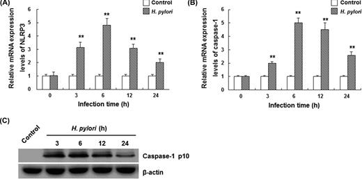 H. pylori infection promotes NLRP3 and caspase-1 activations in THP-1 cells. PMA-differentiated THP-1 cells were infected with H. pylori at 100 MOI for 3, 6, 12 and 24 h, respectively. (A and B) The mRNA expression levels of NLRP3 (A) and caspase-1 (B) were detected by quantitative real-time PCR (n = 3). Data were normalized to GAPDH. Compared with the control group, **P < 0.01. (C) Western blot analysis of mature (p10) form of caspase-1. One representative blot from three independent experiments is shown.