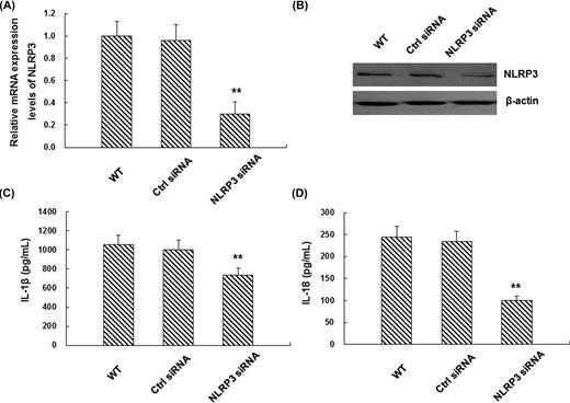 NLRP3 is necessary for H. pylori-induced IL-1β and IL-18 production in THP-1 cells. (A and B) THP-1 cells were transfected with non-target control siRNA (ctrl) or NLRP3-specific siRNA. The mRNA (A) and protein (B) expression levels of NLRP3 were detected by real-time PCR (n = 3) and western blot analysis (one representative blot from three independent experiments is shown), respectively. (C and D) 24 h later, siRNA-transfected THP-1 cells were infected with H. pylori at 100 MOI for another 12 h and the levels of IL-1β (C) and IL-18 (D) were measured by ELISA (n = 3). Compared with the wild-type (WT) control group, **P < 0.01.