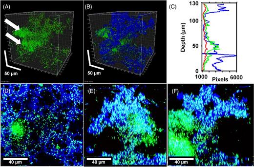 Pseudomonas aeruginosa PittD biofilm showing cells stained with Molecular Probes Live (green)/Dead (red) BacLight LIVE/DEAD Kit and reflected signal from the EPS stained with KMnO4 contrast enhancer (blue). (A) Signal from green and red channels showing a conventional LIVE/DEAD view of the biofilm, eDNA staining is indicated by the white arrows. (B) Same image as ‘A’ with blue reflected signal from KMnO4 revealed large amounts of EPS between individual cells. Scale = 50 μm. (C) The biomass distribution depth profile showing the vertical distribution of live (green), dead (red) and EPS (blue) signal. (D) XY plan view of the base of the biofilm revealed a network of EPS connecting individual bacteria. (E) and (F) XZ and XY side views, respectively, with the base of the biofilm at the bottom showing the EPS forming convoluted structures growing into the overlying liquid medium. There was a dense cluster of cells (shown by arrows in panel (A) and to the left in panel (E) that did not stain with KMnO4 but appeared to contain eDNA (diffuse green). Panels (E), (F) and (G): scale = 40 μm, sections are projections of 10 μm thick.