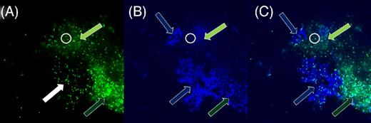 Potassium permanganate does not strongly stain biofilm eDNA. Pseudomonas aeruginosa PittD biofilm stained with BacLIght LIVE/DEAD and KMnO4. (A) The green signal from the Syto 9 shows brightly stained individual bacterial rods (a representative group indicated by the white filled arrow and two cells inside the white circle) as well as diffuse, less intense, staining between the cells (light and dark green arrows indicate less and more intense areas of diffuse staining, respectively). The diffuse staining surrounding cells is consistent with that of eDNA. (B) The blue reflected signal from the KMnO4 shows a weak reflected signal in these same areas, but shows strong signal in areas where there are no significant amounts of eDNA (blue arrows). There is a weak reflected signal from the individual cells (white circle). (C) Overlay of the two images show the eDNA and KMnO4 staining are not colocalized. Images A and B are raw tiff files.