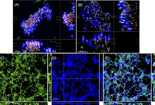 Pseudomonas aeruginosa PAO1 biofilms showing cells stained with Molecular Probes Live (green) /Dead (red) BacLight Kit and reflected signal from the EPS stained with KMnO4 contrast enhancer (blue). (A) and (B) plan (XY) and side (XZ and YZ) views of two different biofilms showing EPS connecting cells and extending into the liquid growth medium. Scale = 10 μm. Web-like structures at the base of the biofilms were also observed in the PAO1 biofilms (D–F). (D) ‘Conventional’ Live / dead image without KMnO4, (E) reflected signal from KMnO4 staining, (F) combined image showed that cells were connected along webs of EPS. Panels show square XY plan view, and XZ and YZ side views below and to the right of the plan view. Scale = 30 μm.