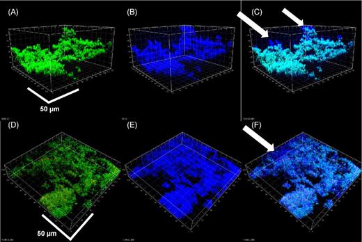 Biofilms of S. mutans (A–C) and S. aureus (D–F) shown by conventional LIVE/DEAD kit staining (A, D), reflection from KMnO4 staining (B, E) and the combined images (C, F). Colocalization of green/red and blue channels (bacteria which were stained with LIVE/DEAD kit and also giving a strong reflected signal appeared light blue. In contrast with the P. aeruginosa biofilms, the EPS was more localized to the bacteria, however, in both biofilms there were some areas that had EPS, but were relatively devoid of bacteria (arrows). Scale bars = 50 μm.
