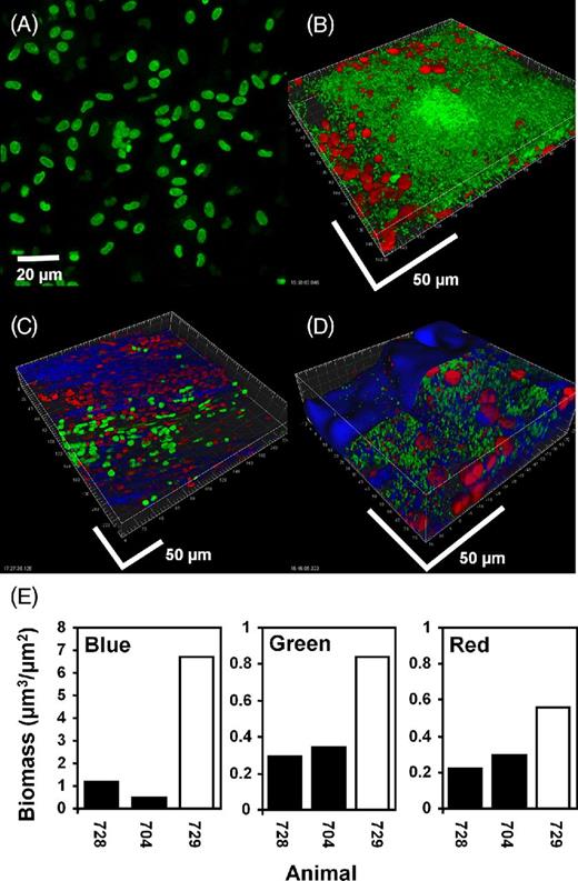Mucosal P. aeruginosa PAO1 biofilm in the bulla in the chinchilla stained for cells with live (green) / dead (red) kit and KMnO4 (blue). (A) and (C): uninoculated controls. The nuclei of host epithelial cells stained initially primarily with Syto 9 (green) but over the imaging time became red as they absorbed PI. Cells with approximate equal proportions of the two stains appeared yellow. KMnO4 revealed matrix material between the cells. (B) and (D): bullae from two animals inoculated with PAO1. Bacterial rods stained green indicating that they were viable. Unlike the host cells, bacterial cells did not integrate PI, making the majority of bacteria readily distinguishable from the nuclei of host cells on the basis of size, morphology and differential staining. (D) After staining with KMnO4 material between and colocalized with the biofilm cell clusters was visible (blue). Biofilm bacteria and the nuclei of host cells did not appear morphologically or structurally different from the specimen stained only with the BacLight kit. Scale bars = 50 μm. (E) COMSTAT analysis of confocal images from the bullae of two uninoculated animals (black bars) and an animal infected with PAO1 (open bar) stained with BacLight LIVE/DEAD kit and KMnO4 and RM. Reflected signal from the KMnO4 (blue), live bacteria (green) and host nuclei (red).