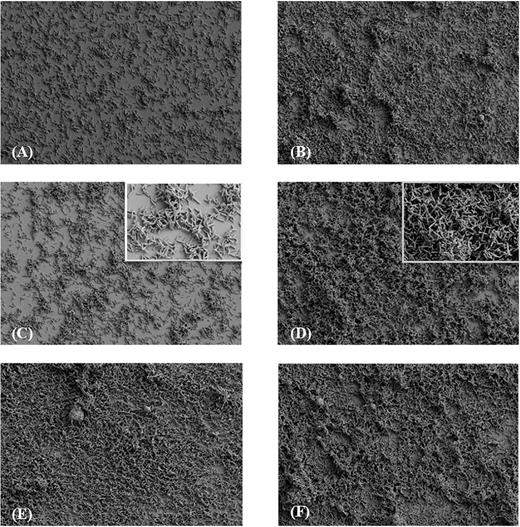 FESEM analysis of C. difficile strains biofilms. A metronidazole concentration of 1/2 of the MIC value for each strain was used. Biofilms were obtained at an accelerating voltage of 2 kV and a magnification of 1000×. (A) 7032994 strain, (B) 7032994 in presence of metronidazole; (C) 7032985 strain, including a 5000× magnification photo; (D) 7032985 in presence of metronidazole, including a 5000× magnification; (E) 7032989 strain; (F) 7032989 in presence of metronidazole.