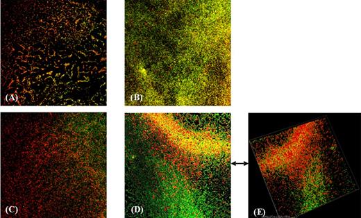 CLSM analysis of biofilms formed by C. difficile strains in presence and absence of metronidazole. The red-fluorescent propidium iodide stain labels bacteria, while the lectin Concanavalin A binds to residues of the exopolysaccharides matrix. The concentration of metronidazole used was 1/2 of the MIC value for each strain. (A) 7032994 strain, (B) 7032994 in presence of metronidazole, (C) 7032985 strain, (D) 7032985 in presence of metronidazole and (E) three-dimensional image of 7032985 biofilm in presence of metronidazole.