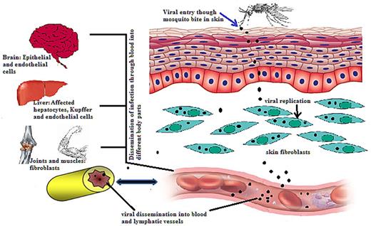 A schematic representation of the systemic Chikungunya virus dissemination. The Chikungunya virus enters the host cell by the mosquito bite. The virus then replicates into fibroblasts of skin and enters nearby lymph nodes through which it disseminates into the blood. The Chikungunya virus further migrates to different organs and tissues through blood vessels.