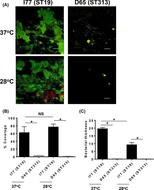 Biofilm formation of (A) Salmonella Typhimurium D65 (ST313) and Salmonella Typhimurium I77 (ST19) grown in continuous flow cells. The white bar on the figure represents 50 μm. (B) Percent coverage of the biofilms determined by viewing 10 different fields of view. (C) The average biofilm thickness on the surface of the glass in μm. Asterisk represents P < 0.05.