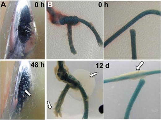 Biofilm outgrowth on infected explanted materials. (A) Anterior face of femoral component, (B) braided suture; 0 h–0 h of growth, 48 h–48 h of growth, white arrow indicates bacterial outgrowth.