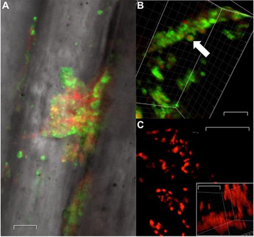 Confocal microscopy of biofilm on representative suture material. (A) Confocal image at ×63 magnification, (B) WGA488 stain of biofilm component of S. aureus at ×100 magnification, (C) 2D lateral image projection of suture (×100 magnification, ×6 optical zoom) with DNA stain, white arrow indicates bacterial cell. Inset image represents a 3D image stack of the same filed. Scale bars represent 5 μm.