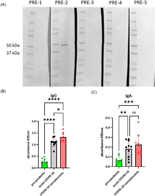 Recognition of SARS-CoV-2 N-protein by pre-immune sera. (A) The result of western blot performed on SARS-CoV-2 lysate and pre-pandemic individual sera. (B) The result of ELISA performed on recombinant SARS-CoV-2 N-protein to measure the level of specific IgG antibodies in pooled sera (means ± standard deviations). (C) The result of ELISA performed on recombinant SARS-CoV-2 N-protein to measure the level of specific IgA antibodies in pooled sera (means ± standard deviations). Ordinary one-way ANOVA with a post-hoc Tukey’s multiple comparison test was used for data analysis, significant differences are marked as (α = 0.05): *P < .05; **P < .01; ***P < .001; ****P < .0001.