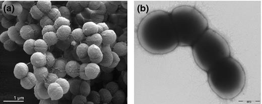 Electron microscopy images of bacteria from the Anaerococcus species. Scanning electron micrograph of (a) Anaerococcus prevotii . Reproduced from (Labutti et al ., 2009 ) (b) Anaerococcus senegalensis . Reproduced from (Lagier et al ., 2012 ). 