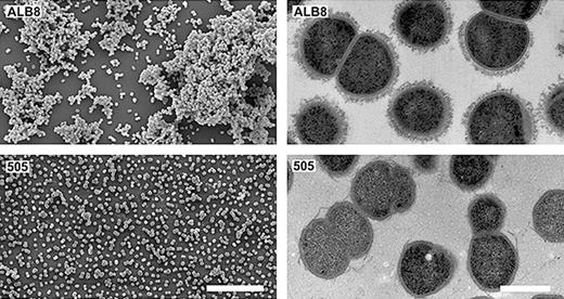  Electron microscopy images of Finegoldia magna ALB8. Left: Scanning electron micrographs of F. magna strains ALB8 (top row) and 505 (non-FAF expressing strain) (bottom row) Bar represents 10 μm. Right: Transmission electron micrographs of same. Bar represents 5 μm. Reproduced with premission from (Frick et al ., 2008 ). 