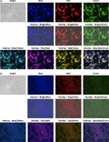 Fluorescence images of YPH499 yeast cells transformed with TagBFP, mKate2 and TagGFP2 triple expression plasmids. Yeast cells transformed with multi-copy pATP422-B1R2G3 plasmid (a) and integration pATP402-B1R2G3 plasmid (b) were grown in SD selectable media for 24 h. Blue, red and green fluorescence images were acquired with a DAPI-BP filter (ex. 360/40 nm, em. 460/50 nm), a GFP-BP filter (ex. 470/40 nm, em. 535/50 nm), and a Texas-Red filter (ex. 560/40 nm, em. 630/60 nm), respectively. Exposure time; (a) bright, 1/20 s; blue, 3.5 s; red, 1/70 s; green, 1 s; and for (b) bright, 1/20 s; blue, 10 s; red, 1/10 s; green, 3 s.