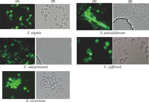 Detection of recombinant GFP-producing yeast cells by fluorescence microscopy. Transformants were cultured for 18 h in YEPD medium at 30°C. The cells were washed twice with 0.9% NaCl and subsequently used for fluorescence analysis. A, GFP fluorescence; B, transmission.
