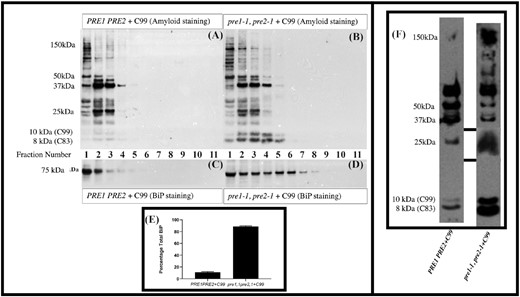 The ER chaperone BiP is mislocalized and upregulated in cells, with compromised proteasome activity, when expressing C99. Cell extracts were partially resolved by sucrose density gradients and analyzed by immunoblotting in triplicate as described in Materials and methods. Fractions 1–11 refer to the fractions taken from the top of the sucrose gradient (Fraction 1) to the last fraction at the bottom of the gradient (Fraction 11). Co-localization studies have shown that fractions 1–4 are enriched for endoplasmic reticulum while fractions 9–11 are enriched for plasma membrane. (A) Immunoblot analyses of C99 and/or its fragments in the endoplasmic reticulum and subsequent compartments of wild-type cells. (B) Expression of C99 and/or its fragments in proteasome-mutant cells. (C) BiP expression levels in wild-type cells expressing C99. (D) BiP expression levels in proteasome-mutant cells expressing C99. (E) Summary of the percentage of BiP after running triplicate samples of these gradients, in wild-type versus proteasome-mutant cells expressing C99. This implies activation of the UPR. (F) Loading controls for the sucrose gradient. While proteins/peptides in the 250–37 kDa and 25 kDa ranges sometimes showed differences between the wild-type and proteasome-mutant cells expressing C99, changes in the amount of peptide in the 8–10 kDa size range were always evident with the mutant consistently expressing more of these peptides.