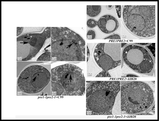 Accumulation of electron dense material in the nuclear envelope/ER of C99-expressing proteasome-mutant yeast cells. TEM images of wild-type or proteasome-mutant yeast cells expressing C99 or carrying an empty vector. Black arrosws indicate electron-dense material and intranuclear inclusions in the nuclear envelope.